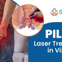 Piles laser treatment in vizag