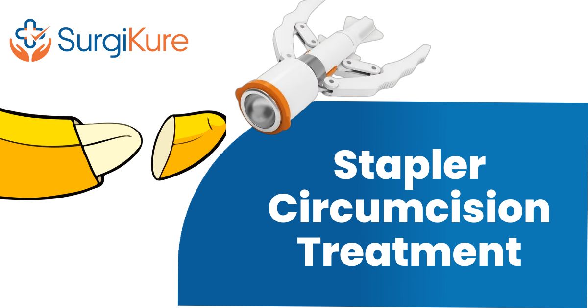 Stapler Circumcision Treatment at Surgikure: A Modern Approach to Safe and Effective Circumcision