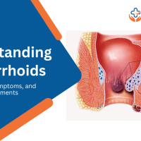 Hemorrhoids Treatment in Vizag