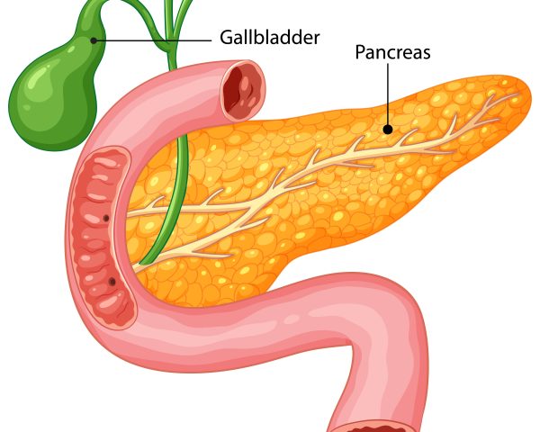 gall bladder stones treatment in Vizag