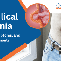 Umbilical Hernia treatment in vizag