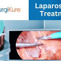 laparoscopy treatment in vizag