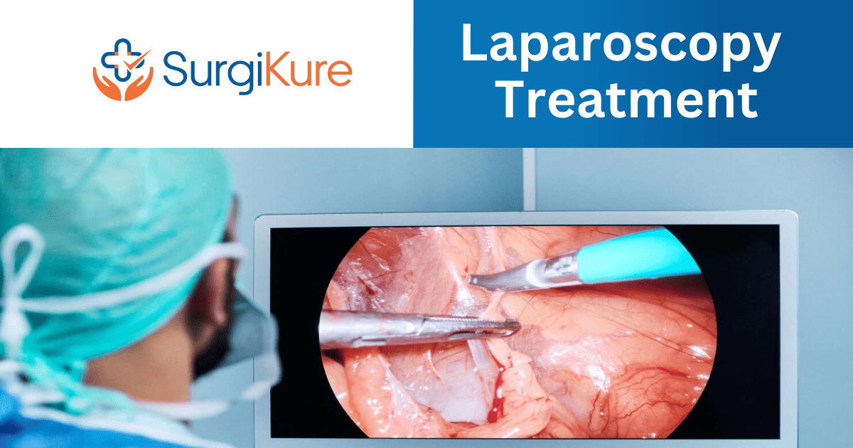 Specialized center for laparoscopy treatment: Your guide to a seamless surgical experience at  Surgikure