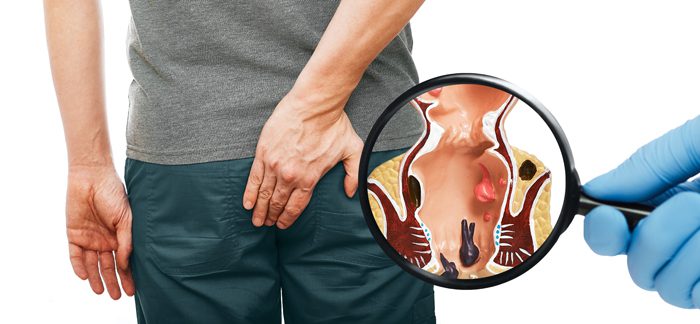 Proctologist Doctor in Visakhapatnam