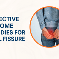 Home Remedies for Anal Fissure
