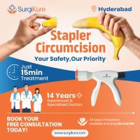 stapler circumcision in hyderabad