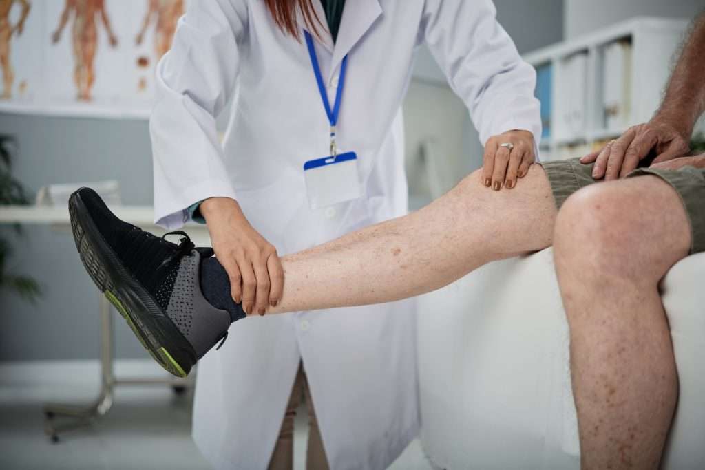 Varicose Veins Treatment