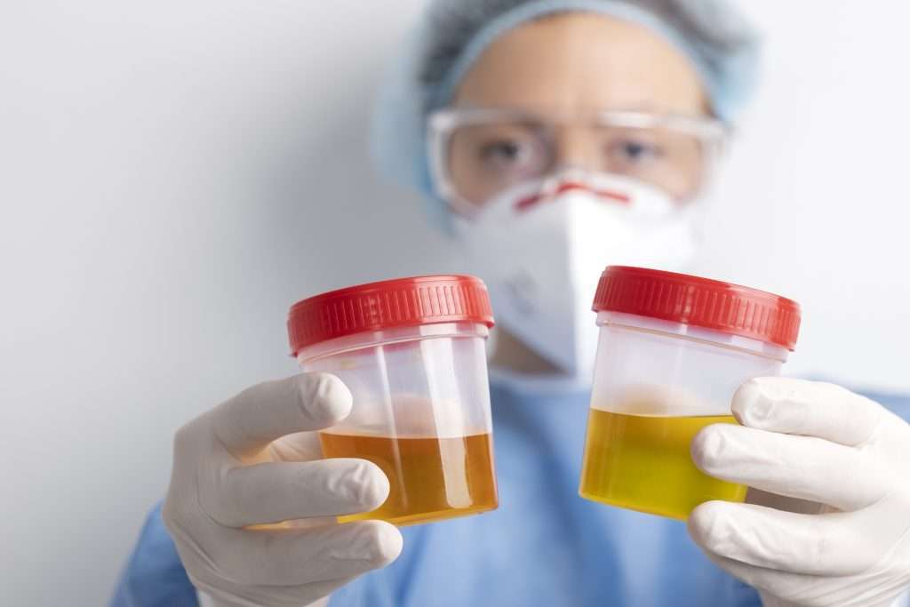 Doctor performing a urinalysis to diagnose the cause of symptoms of urinary tract infections