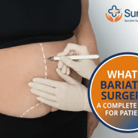 Best Bariatric Surgery in Visakhapatnam