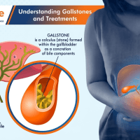 Gallstone Composition