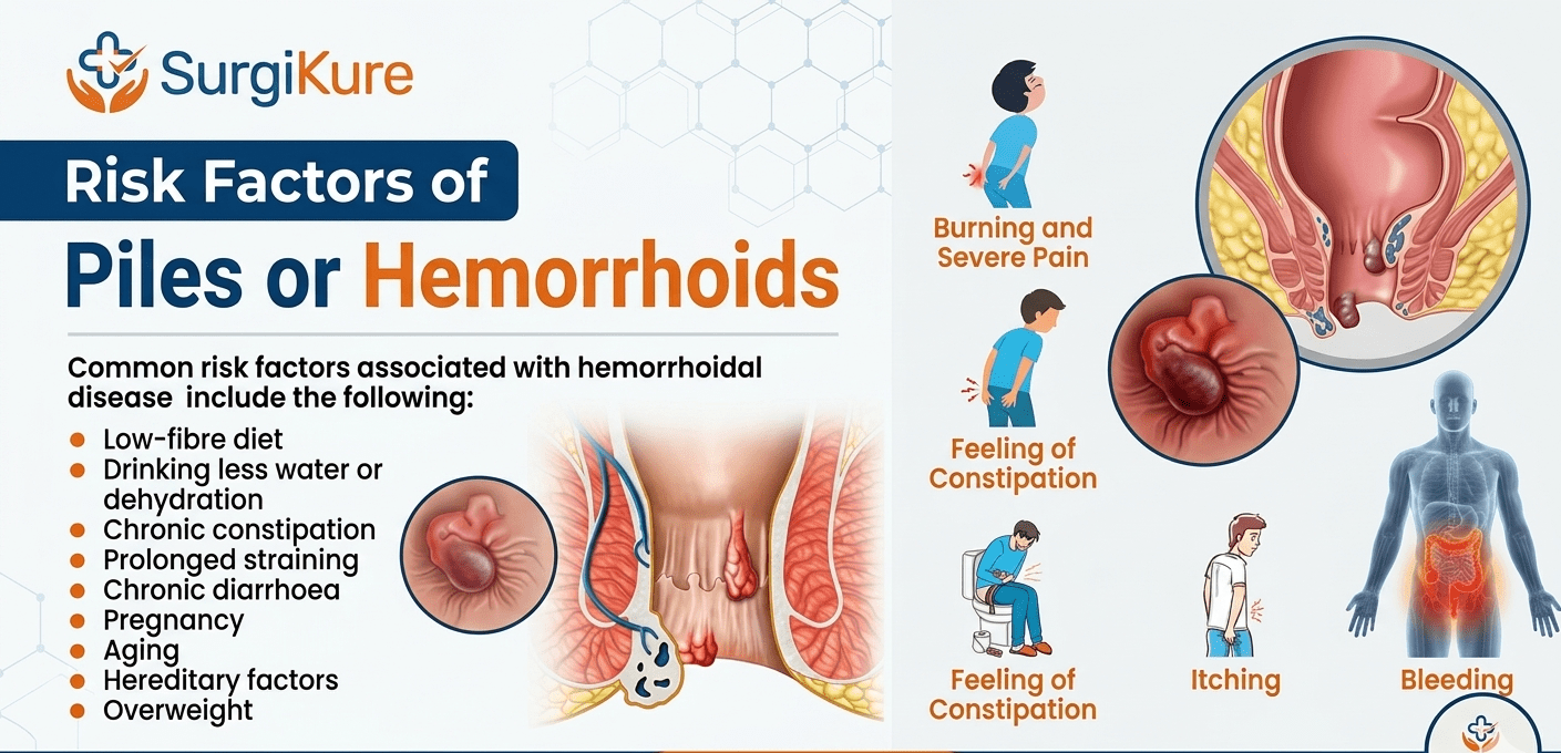 Piles Symptoms with Images: A Complete Visual Guide to Types & Stages