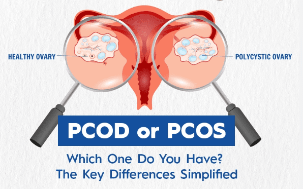 PCOS vs PCOD: Key Differences, Symptoms, Causes & Treatment Options