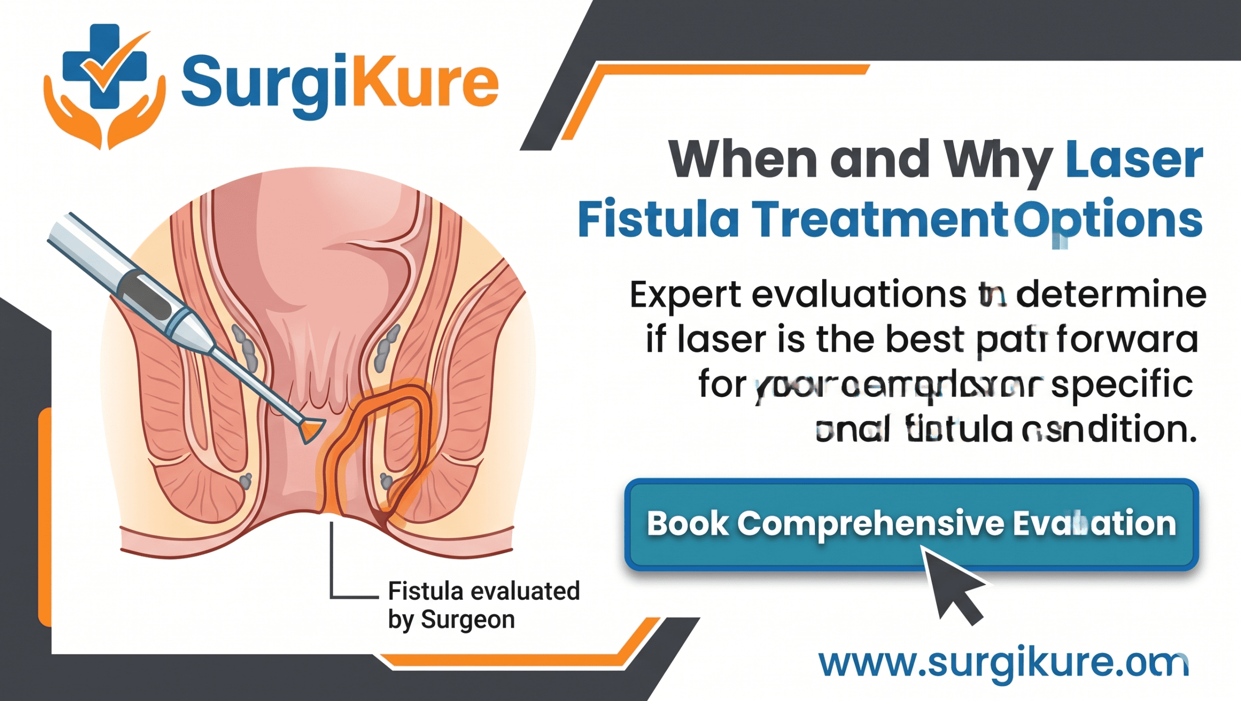 Anal Fistula Treatment in Visakhapatnam with an Advanced Laser Process